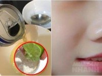 Trộn bia tươi với nước cốt chanh, các nốt mụn cứ thế biến mất, da trắng hồng luôn căng mịn