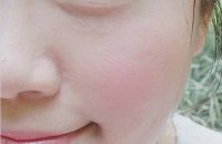 Dùng sữa tươi đắp mặt đã xưa rồi, giờ phải đông đá rồi chà lên mặt như thế này mới tốt cho da cơ