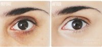 Chỉ với 1 thìa muối, quầng thâm và bọng mắt sẽ một đi không trở lại chỉ sau 5 phút