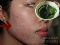 99% bạn gái không biết những điều cấm này dù đắp mặt nạ bột trà xanh mỗi ngày