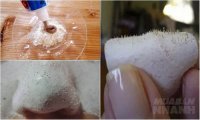 Chỉ cần làm điều này, bạn sẽ triệt tiêu được mụn đầu đen