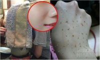 Da mềm mại, sạch mụn lại còn trắng hồng chỉ sau 1 lần xông hơi từ 1 nắm lá chanh