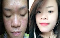 Vắt nước cốt chanh vào thứ này để thoa lên mặt, da trắng mịn bật tông sau 1 tuần mà không lo bị bắt nắng