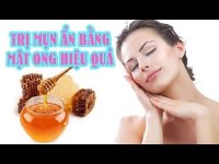 Cách trị mụn ẩn bằng mật ong