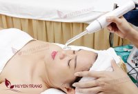Hỗ trợ tiêu viêm trị mụn bằng máy điện tím cầm tay M110A và những điều không ai biết đến