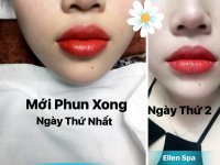 Phun môi bao lâu thì hết sưng?