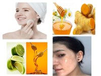 Cách trị mụn hiệu quả cho da dầu