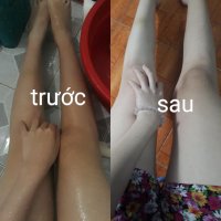 Làm đẹp da 0 đồng từ than gạo hoạt tính