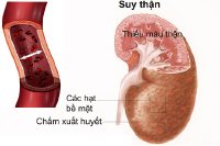 Thận yếu ảnh hưởng tới sinh lý ở nam giới