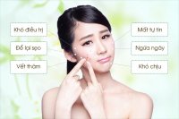 Tác hại của mụn như thế nào đến cuộc sống của bạn?