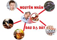 Tại sao người bị dạ dày nên sử dụng An Dạ Hoàng Liên?