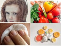 Phòng ngừa nám với biện pháp đơn giản sau