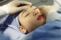 Lý do nhấn mí mắt là gì? Phương thức làm đẹp được nhiều người ưa chuộng