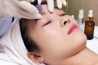 “Thay da siêu vi điểm” không chỉ trị mụn