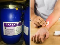 Cách xử lý bị bỏng khi sử dụng hóa chất