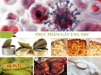 Top 10 thực phẩm khiến bạn mắc ung thư trước tuổi 30