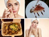 5 điều cần tránh khi da đang bị nổi mụn