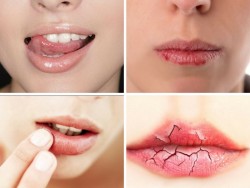 Những tác hại khôn lường của thói quen liếm môi