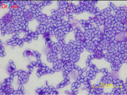 Tổng quan về bệnh vi bào tử trùng trên tôm