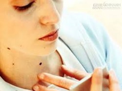 Ý nghĩa nốt ruồi ở cổ và ngực phụ nữ