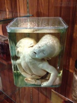 Dựng tóc gáy với bảo tàng trưng bày bộ phận cơ thể người