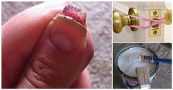 19 công dụng bất ngờ của dây thun không phải ai cũng biết