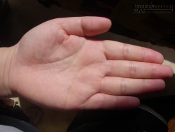 Màu sắc lòng bàn tay nói gì về bạn