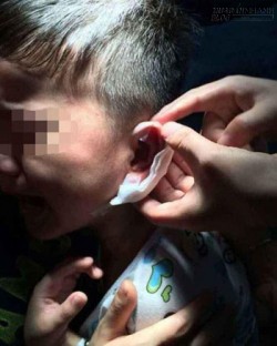 Cô giáo Trung Quốc dập ghim vào tai phạt học sinh