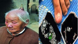 Bất ngờ với những thứ kỳ lạ mọc ra từ cơ thể người