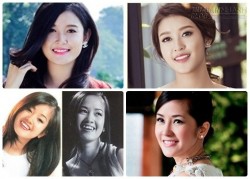 Ngắm 'mỹ nhân' Huyền My, Hồng Nhung... đổi diện mạo nhờ nhổ răng khểnh