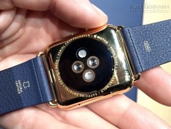 Apple Watch khiến người dùng bỏng tay vì quá nóng