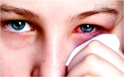 Chữa đau mắt đỏ bằng thuốc nam không cần kháng sinh