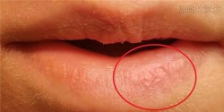 Những lý do không ngờ khiến môi bạn luôn khô và nứt nẻ
