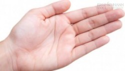 Cách xem nốt ruồi trong lòng bàn tay