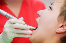 Những điều cần biết về bệnh ung thư lưỡi