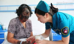 Choáng với người phụ nữ cháy đen mặt chỉ vì ăn rau dền