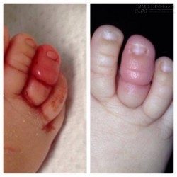 8 Mối nguy hiểm rình rập bé mà mẹ có thể đã bỏ qua!