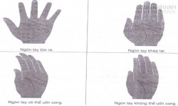 Cách Duỗi Tay & Phán Đoán Ngón Tay Cong