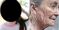 Cô bé 10 tuổi hóa bà lão sau khi sử dụng mỹ phẩm loại bỏ tàn nhang