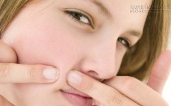 Không nên nặn mụn ở những vùng tử thần nào?