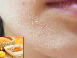 Cứu nguy làn da khỏi nguy cơ bong tróc nứt nẻ khi thu sang