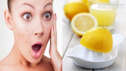 Những sai lầm khi làm đẹp với chanh khiến làn da bạn xấu tệ hại