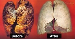 Hút thuốc lá trên 5 năm, hãy làm theo cách này để cứu phổi!