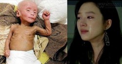 Cậu bé 5 tuổi trở thành ông già chỉ vì ông nội cho uống thứ này hàng ngày