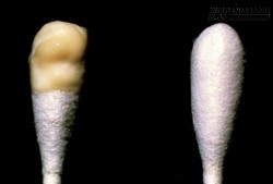 10 nguyên nhân bất ngờ khiến vô sinh chị em nào cũng phải biết