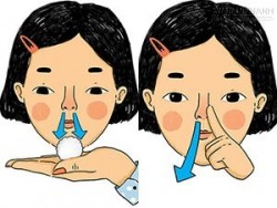 Xì mũi không đúng cách có thể gây viêm xoang, điếc tai