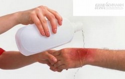 Nằm lòng những cách xử lí khi bị kiến ba khoang tấn công