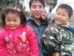 Cảm động hai em bé tình nguyện hiến da đầu cứu cha