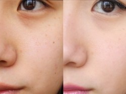 Những mẹo thu nhỏ lỗ chân lông hiệu quả hơn cả mỹ phẩm đắt tiền