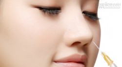 Phẫu thuật nâng mũi có thay đổi vận mệnh?